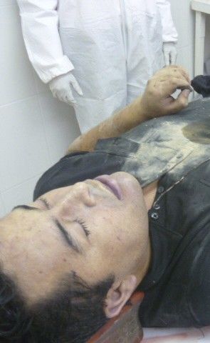Body of Lazcano is seen lying on table after he was killed in a shootout with Marines in a gun battle in northern Mexico