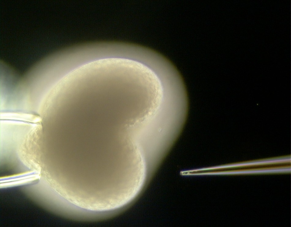 A gene sequence is injected into an embryo of Hydra. A gene sequence is injected into an embryo of Hydra.