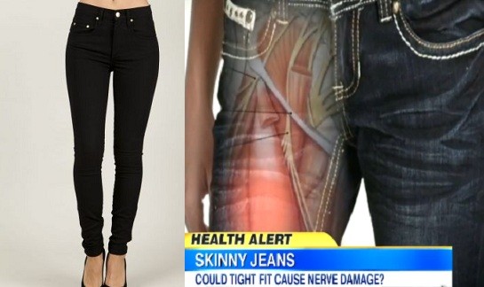 skinny jeans nerve damage