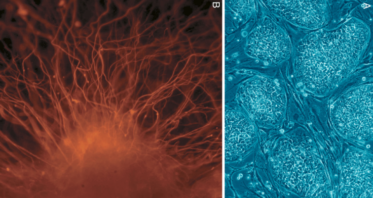 Human embryonic stem cells