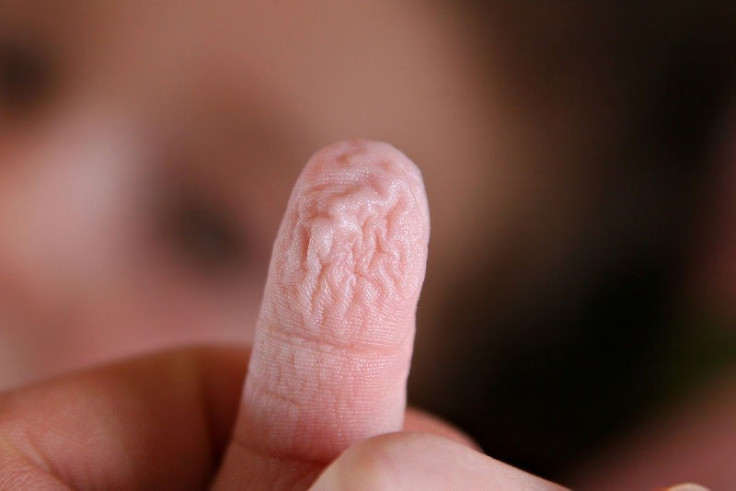 wrinkly finger