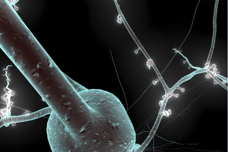 Single neuron from a human brain (Photo: The Human Brain Project)