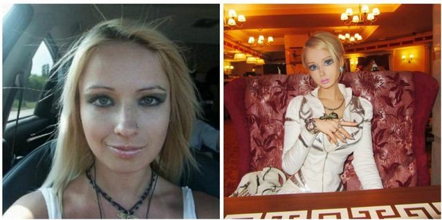 Valeria Lukyanova before and after surgery