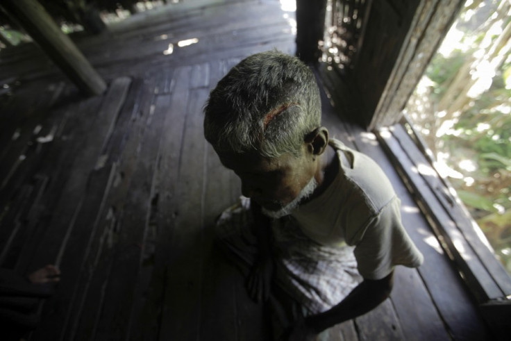 Muhammad Amin, 62, a Muslim man who was beaten with a metal pipe until his skull cracked, sits in his home in Paik Thay, the site of recent violence between Muslim Rohingyas and Buddhist Rakhine people,