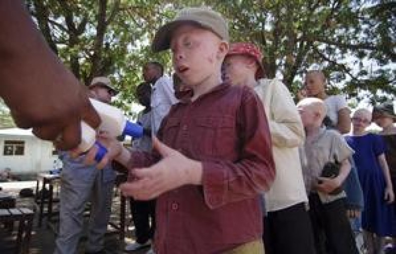 Albino Attacks in Tanzania