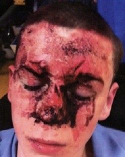 Assault victim