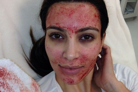 Kim Kardashian's Bloody facial