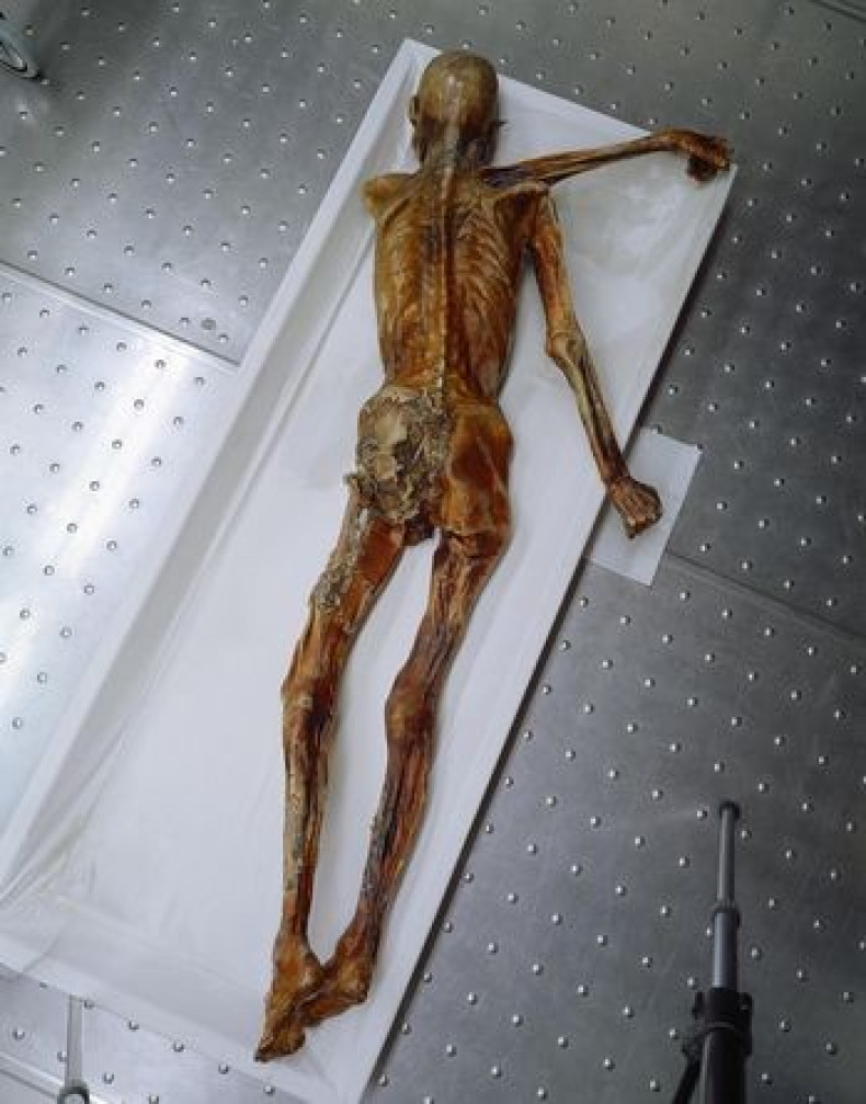 Iceman autopsy