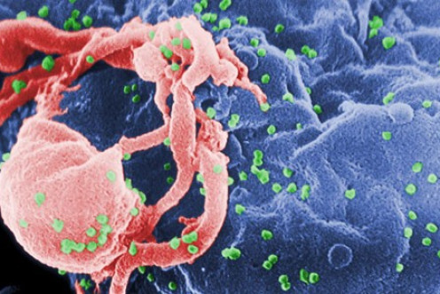 Deadly HIV virus which causes AIDS