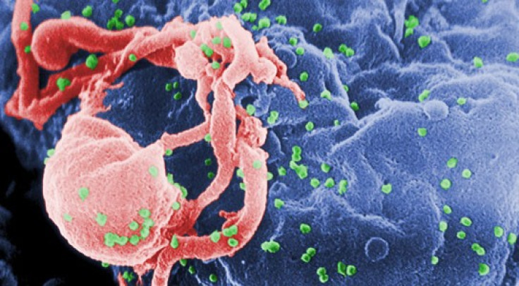 Deadly HIV virus which causes AIDS