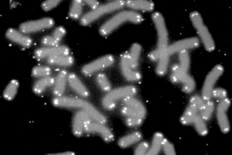 Telomere caps protect chromosomes (Wiki Commons)