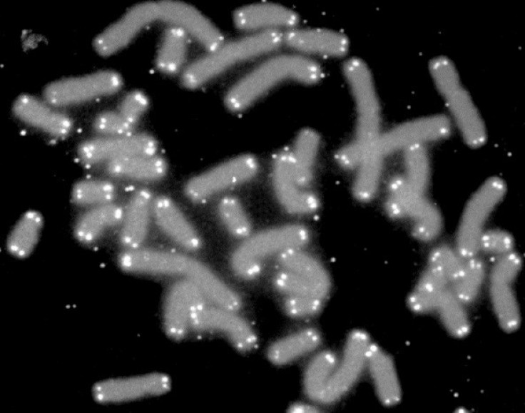 Telomere caps protect chromosomes (Wiki Commons)