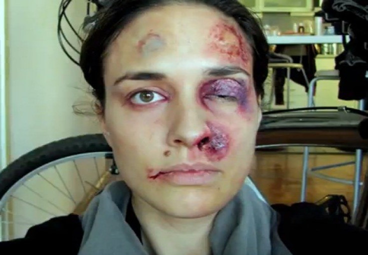 Chilling image: Battered features of woman
