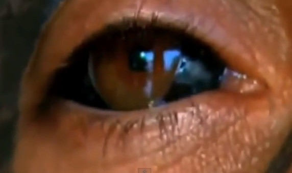Cosmetic tattooing of the cornea can be extremely dangerous, with infection, loss of vision and blindness among the potential complications (YouTube) Cosmetic tattooing of the cornea can be extremely dangerous, with infection, loss of vision and blindness among the potential complications (YouTube)