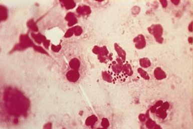 The Gonorrhoea superbug strain could become untreatable and reach epidemic proportions by 2015. (Wikimedia Commons)