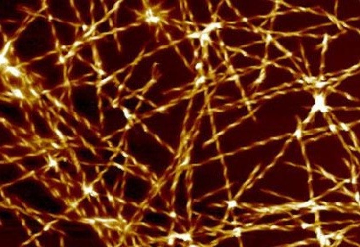 magnified a million times, of amyloid fibril, the type of protein structures that are formed in Alzheimer’s