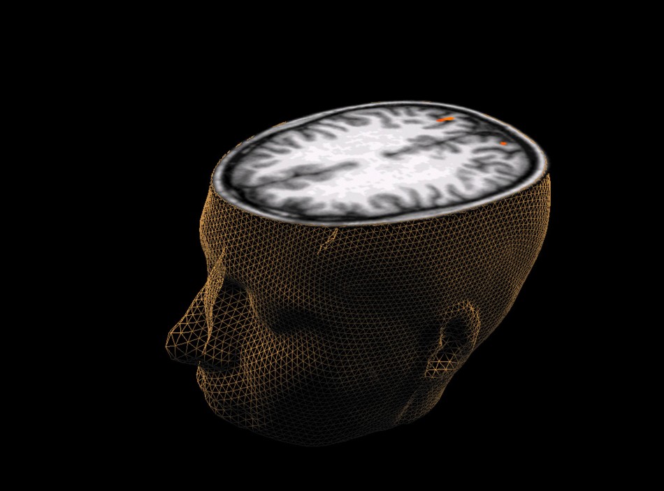 A scientist claims that brain scans can be used to predict which criminals will reoffend. A scientist claims that brain scans can be used to predict which criminals will reoffend.