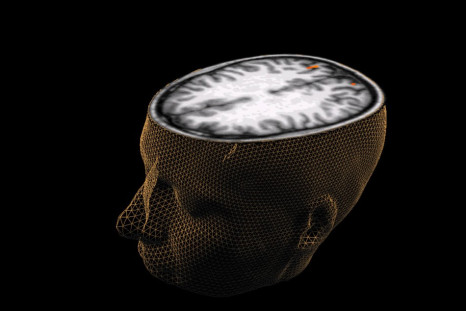 A scientist claims that brain scans can be used to predict which criminals will reoffend.