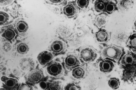 The herpes virus is being harnessed to combat cancer