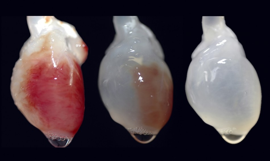 Custom-Made Organs to be Grown in Lab 'Within 10 Years'