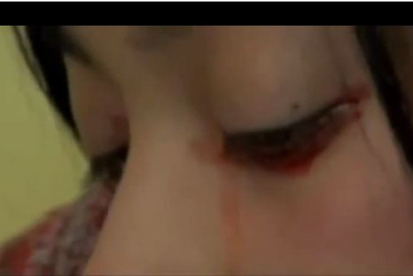 Yaritza Oliva crying tears of blood