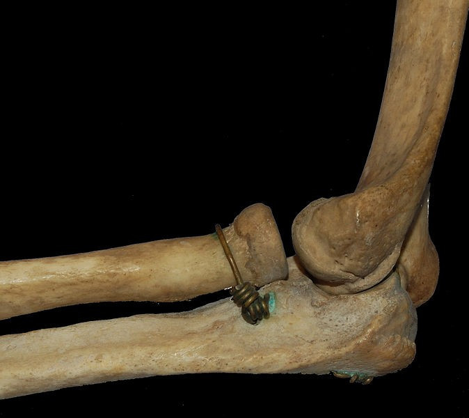 Humerus