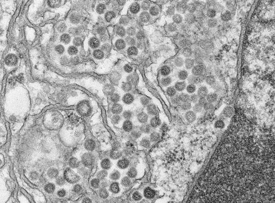 Saudi Arabia: Two-Year-Old is Youngest Mers-CoV Fatality | IBTimes UK