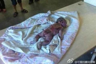 Faulty Incubator at Chinese Hospital Burns Newborn Baby to Death (PHOTOS)