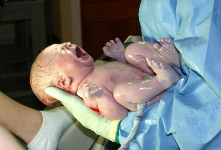 A newborn infant, seconds after delivery. Amniotic fluid glistens on the child's skin. A newborn infant, seconds after delivery. Amniotic fluid glistens on the child's skin.