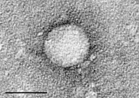 HC virus