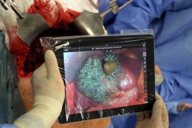 Professor Karl Oldhafer, chief physician of general and visceral surgery at the Asklepios Hospital Hamburg-Barmbek, performs liver surgery, one of the first surgeries of its kind in Germany with the support of an iPad to access and visualize planning data