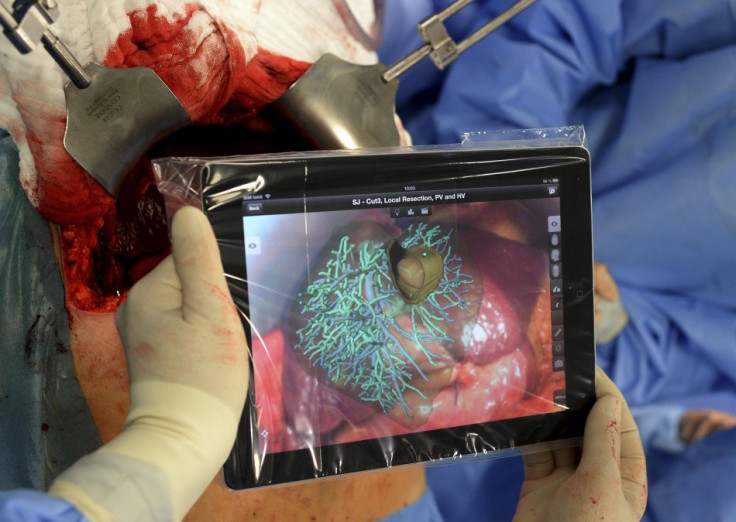 Professor Karl Oldhafer, chief physician of general and visceral surgery at the Asklepios Hospital Hamburg-Barmbek, performs liver surgery, one of the first surgeries of its kind in Germany with the support of an iPad to access and visualize planning data