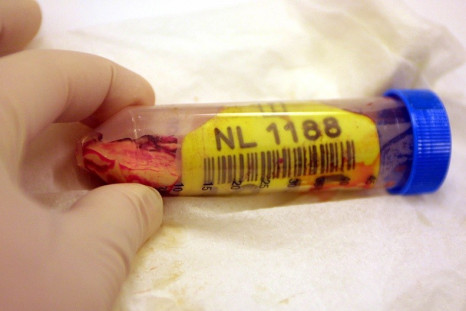 A section of cow brain is tested for Creutzfeldt-Jakob Disease, or mad cow's disease