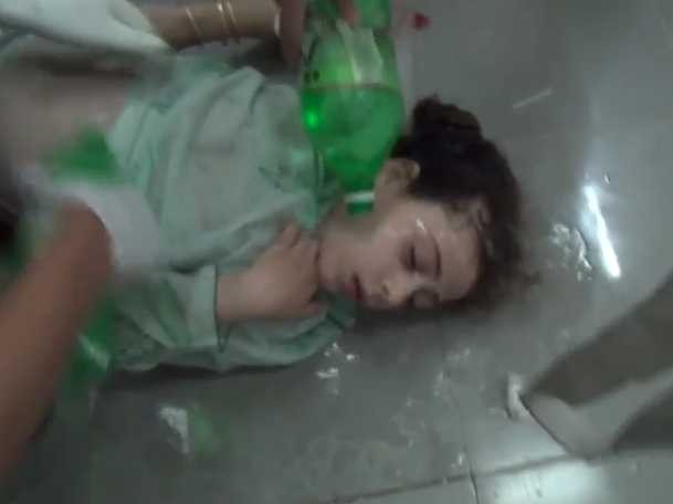 Suspected victim of chemical weapons attack in eastern Damascus