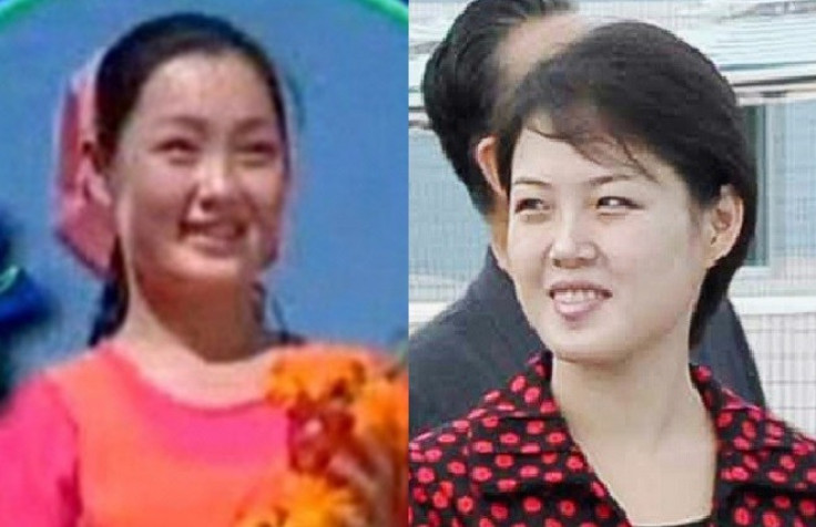 Hyon Song-Wol