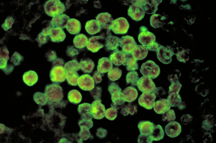 Naegleria fowleri, also known as the brain-eating amoeba, has a fatality rate at over 90%. (Wikicommons)