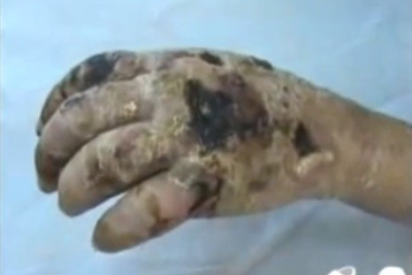 Krokodil