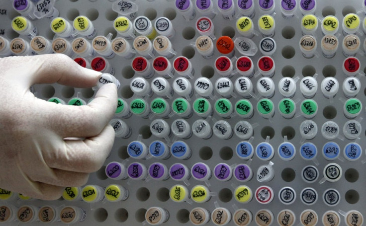 Human DNA samples in a laboratory in Munich.