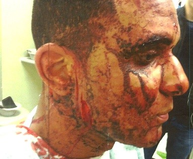 One of the men smashed a glass bottle into Hounye's face (Met Police) One of the men smashed a glass bottle into Hounye's face (Met Police)