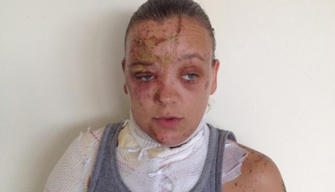 Tara Quigley said the attack has left her feeling as her life had been had been 'blown apart' (Met Police) Tara Quigley said the attack has left her feeling as her life had been had been 'blown apart' (Met Police)