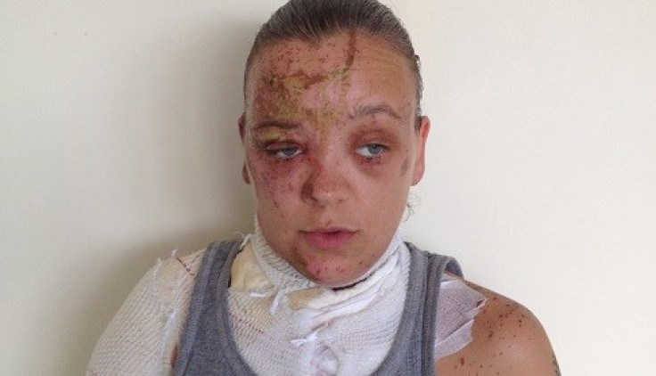 Tara Quigley said the attack has left her feeling as her life had been had been 'blown apart' (Met Police)