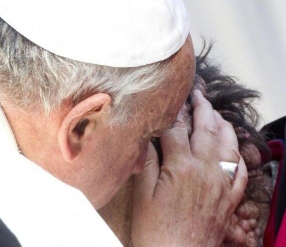 Pope Francis Kiss sick man