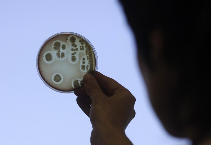 As more antibiotics enter the general population, bacteria become more resistant to them. (Reuters) As more antibiotics enter the general population, bacteria become more resistant to them. (Reuters)