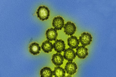 H1N1  Influenza Virus Particles