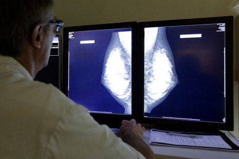 A doctor looking at X-Rays of a Breast.