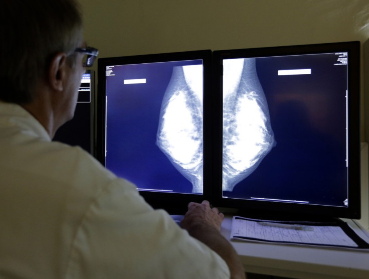 A doctor looking at X-Rays of a Breast.