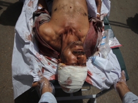 Suicide Bomber Kills 4 people in Karachi