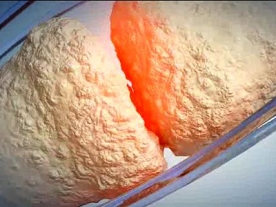 New Drug Gives Hope to Rheumatoid Arthritis Patients