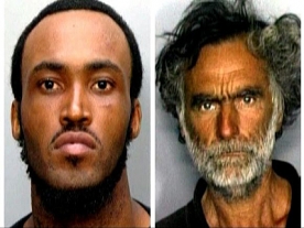 Hospital Releases Photos of Face Chewing Victim