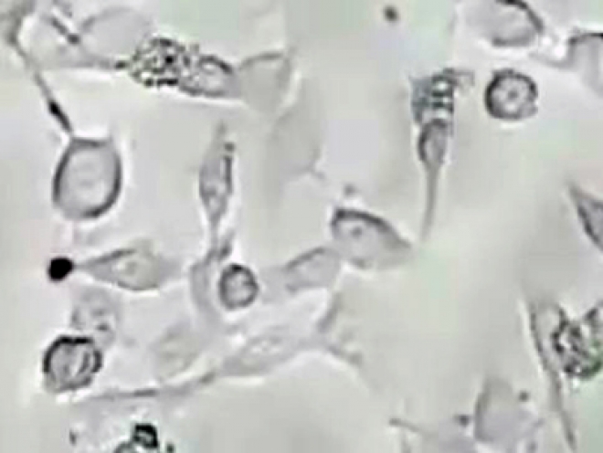 10 killed in Karachi by deadly Brain- Eating Amoeba